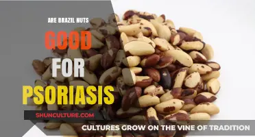Brazil Nuts and Psoriasis: Unlocking Skin Health Benefits Naturally