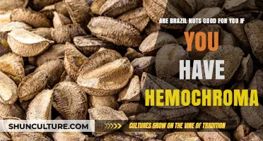 Brazil Nuts and Hemochromatosis: Benefits or Risks for Iron Overload?