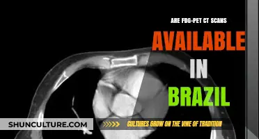 FDG-PET CT Scans in Brazil: Availability and Accessibility Explained