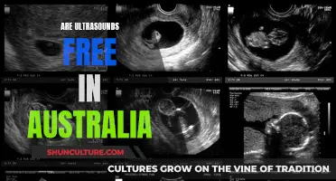 Ultrasounds in Australia: Who Pays?