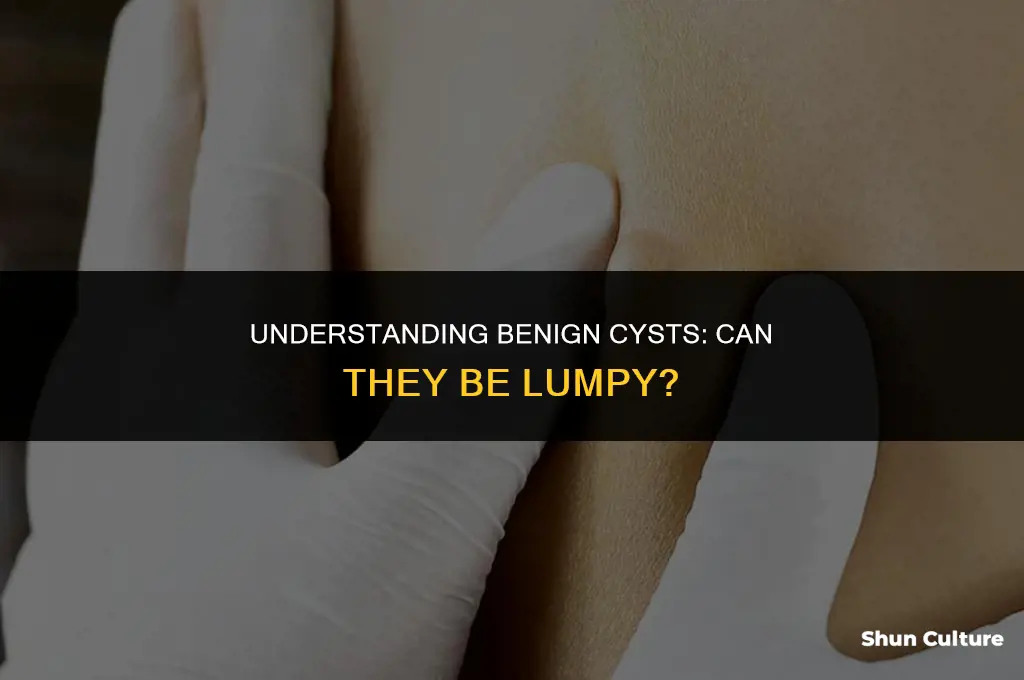 can a benine cyst be lumpy