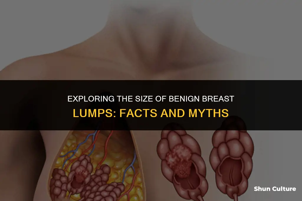 can a benine lump in breast be large