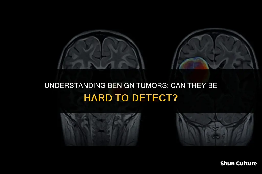 can a benine tumor be hard