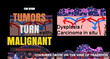 Exploring the Potential Malignancy of Benign Tumors: Facts and Myths