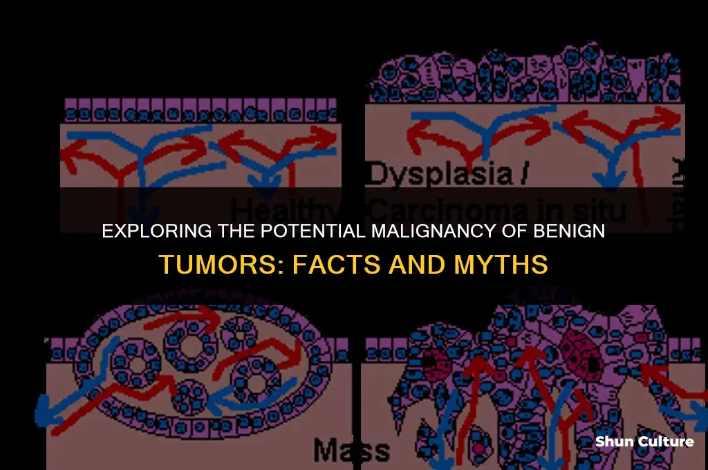 can benin tumors turn malignant