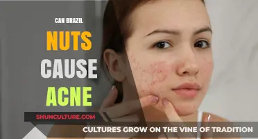 Brazil Nuts and Acne: Uncovering the Skin Impact Connection