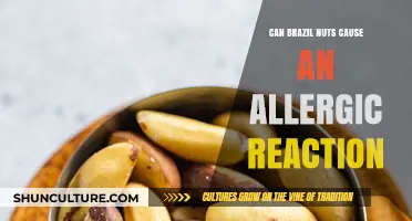 Brazil Nuts Allergy: Symptoms, Risks, and Prevention Tips Explained