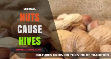 Can Brazil Nuts Trigger Hives? Understanding Allergic Reactions and Symptoms