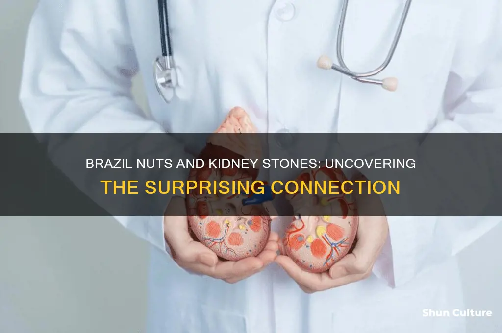 can brazil nuts cause kidney stones