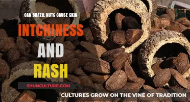Brazil Nuts and Skin Reactions: Itchiness, Rashes, and Allergies Explained