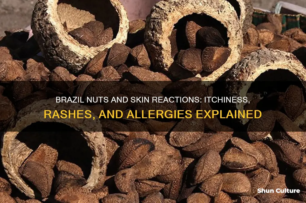 can brazil nuts cause skin intchiness and rash