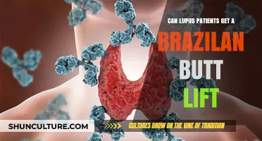 Lupus and BBL: Safety Considerations for Brazilian Butt Lift Procedures
