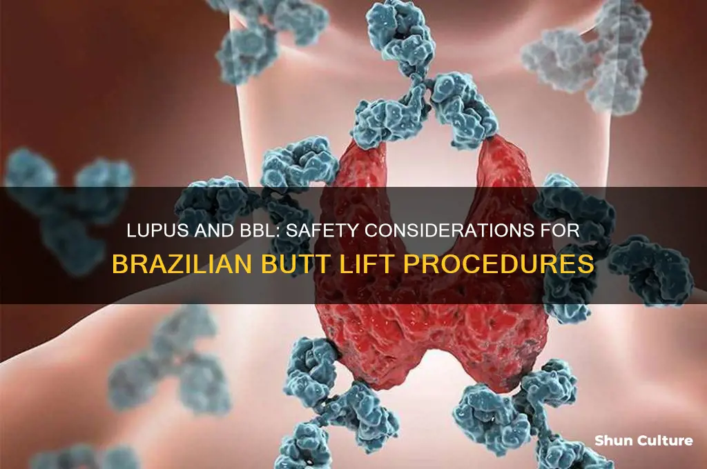 can lupus patients get a brazilan butt lift