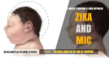 Brazil Confirms Zika-Microcephaly Link: What You Need to Know