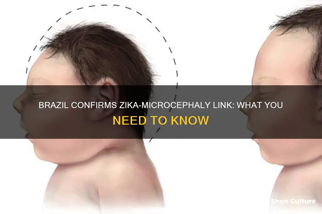 did brazil confirm a link between zika and mic