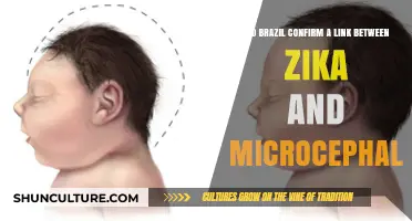 Brazil Confirms Zika Virus Link to Microcephaly: Key Findings Explained