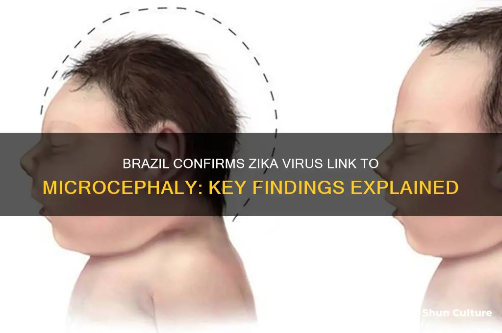 did brazil confirm a link between zika and microcephaly