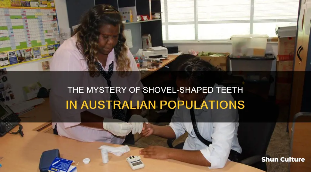 do australian australoid people have shovel shaped teeth