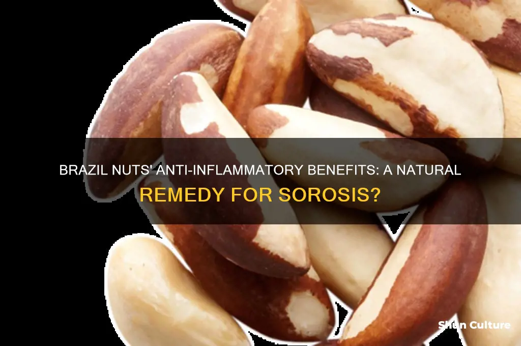 do brazil nuts have anti inflamarity characterists good for sorisis