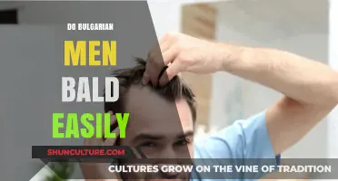 Exploring the Truth: Do Bulgarian Men Really Bald Easily?