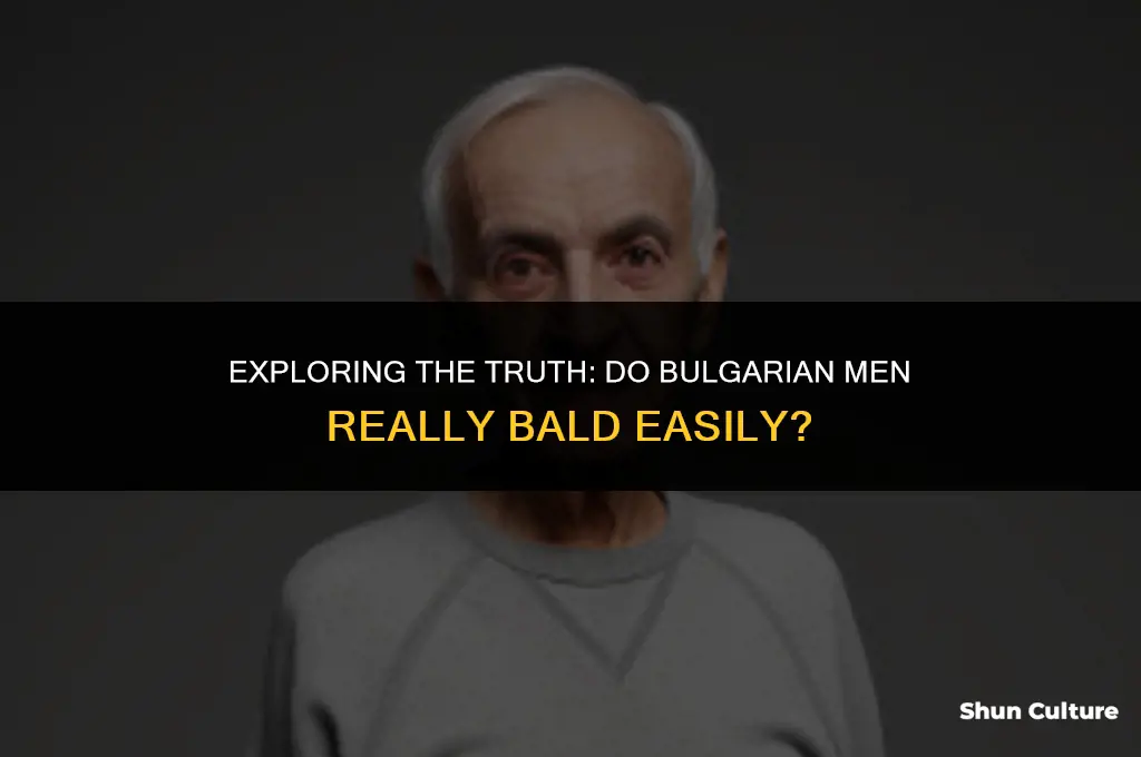 do bulgarian men bald easily
