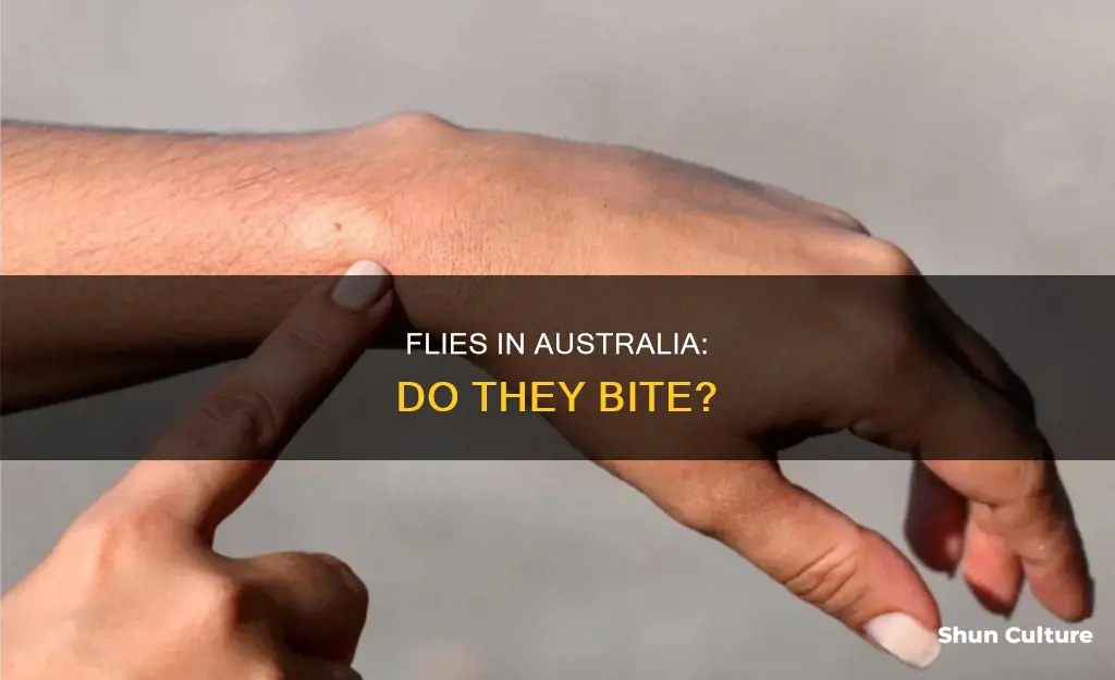 do flies bite australia