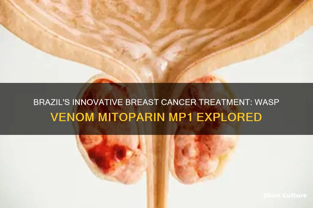 does brazil treat breast cancer with wasp venom mitoparin mp1