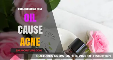 Bulgarian Rose Oil and Acne: Separating Facts from Myths