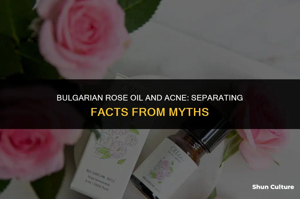 does bulgarian rose oil cause acne
