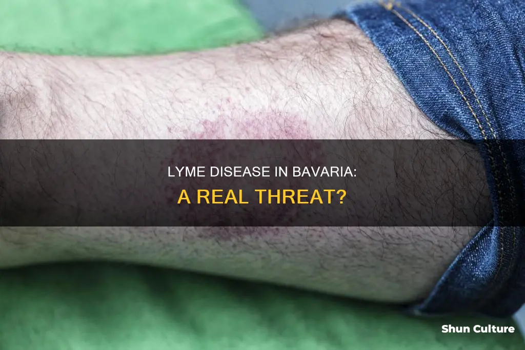 does lyme disease exist in bavaria germany