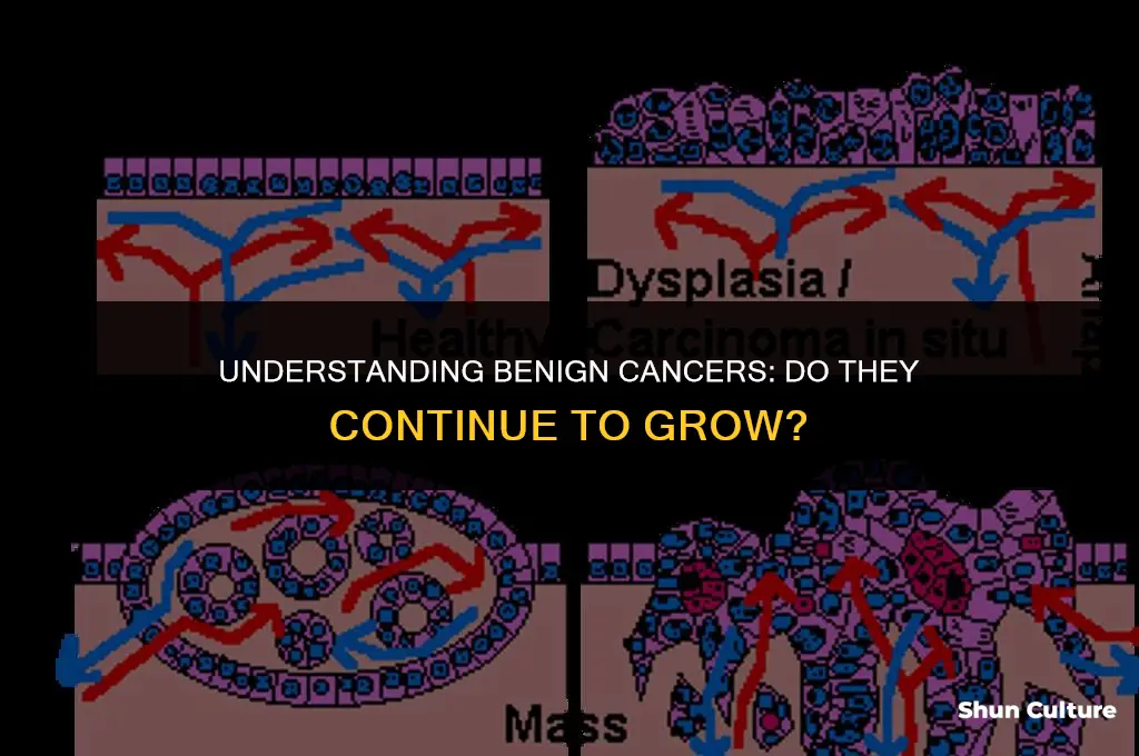 does the benine cancers continue growing