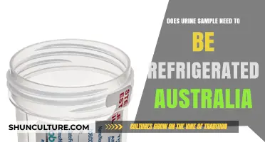 Urine Sample Storage: Refrigeration Requirements in Australia Explained