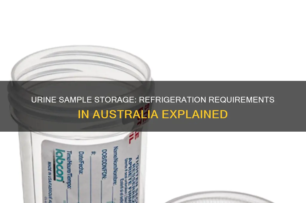 does urine sample need to be refrigerated australia