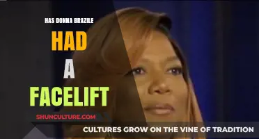 Has Donna Brazile Had a Facelift? Examining the Rumors