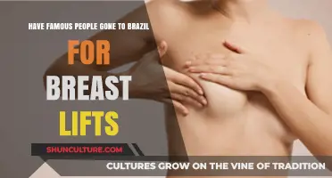 Celebrities Traveling to Brazil for Breast Lift Procedures: Fact or Fiction?