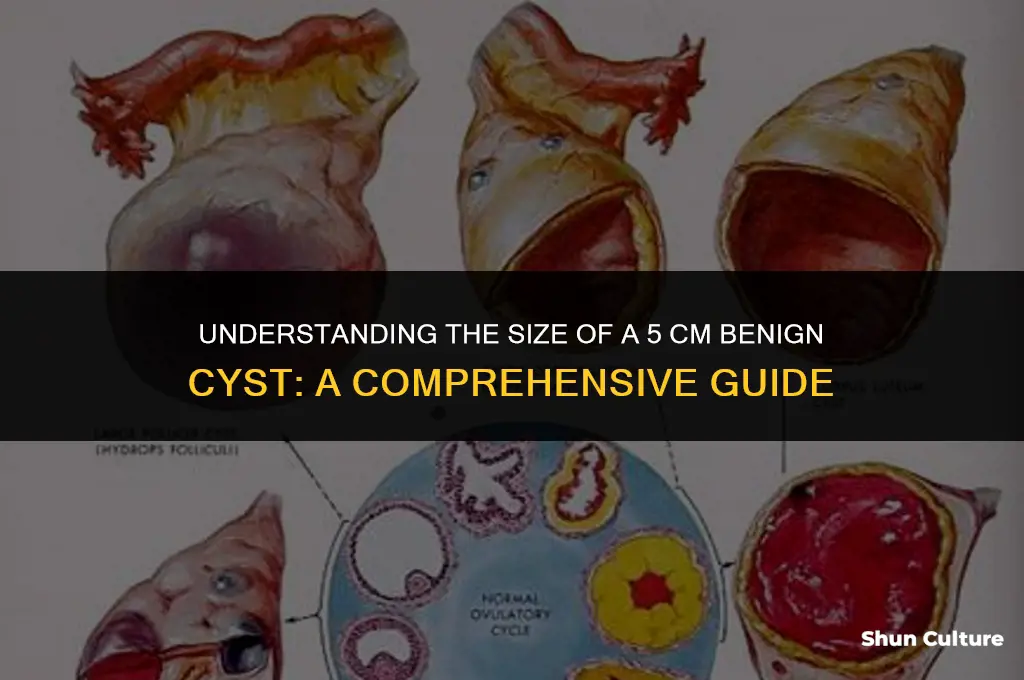 how big is 5 cm benine cyst