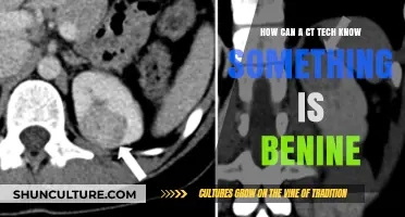 Identifying Benign Cases in CT Scans: A Guide for Technicians