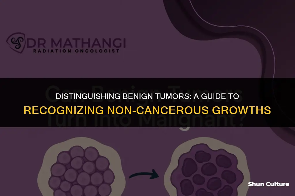 how can you tell a benine tumor