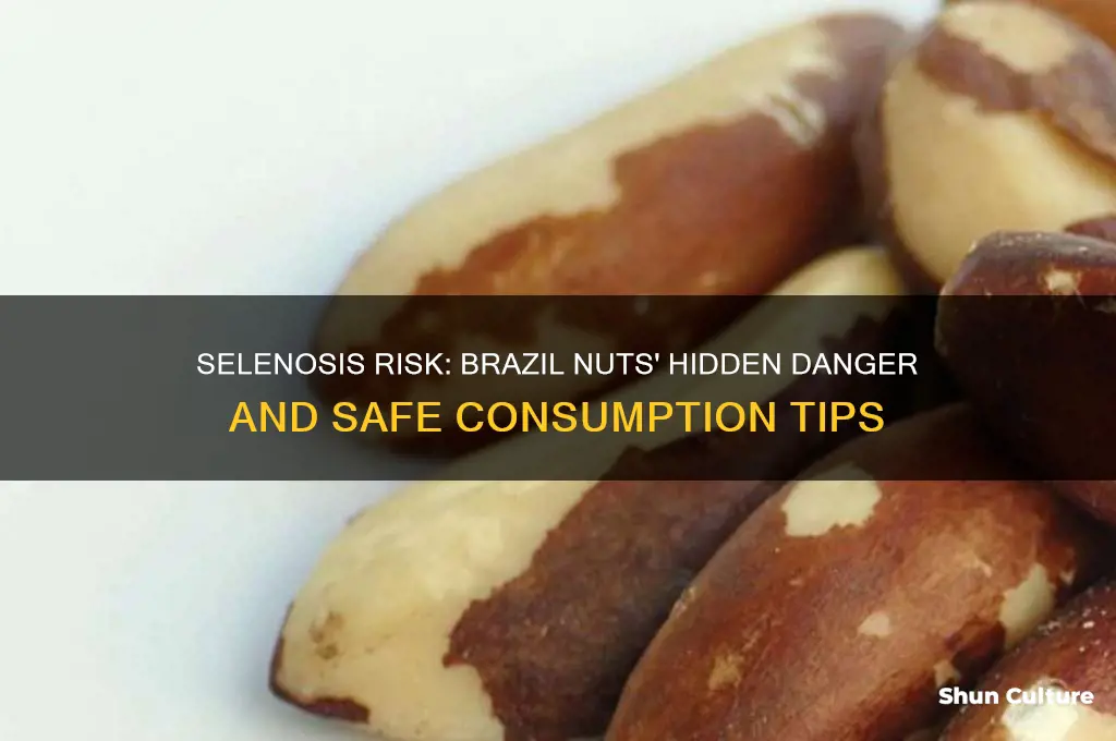 how like is selenosis from brazil nuts