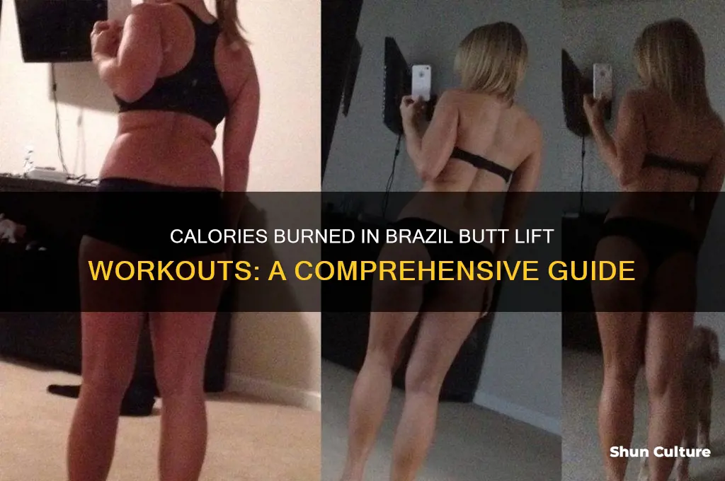 how many calories does brazil butt lift burn