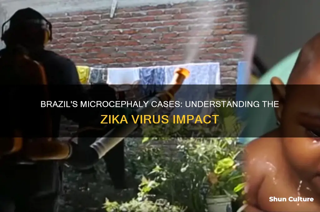 how many cases of microcephaly in brazil