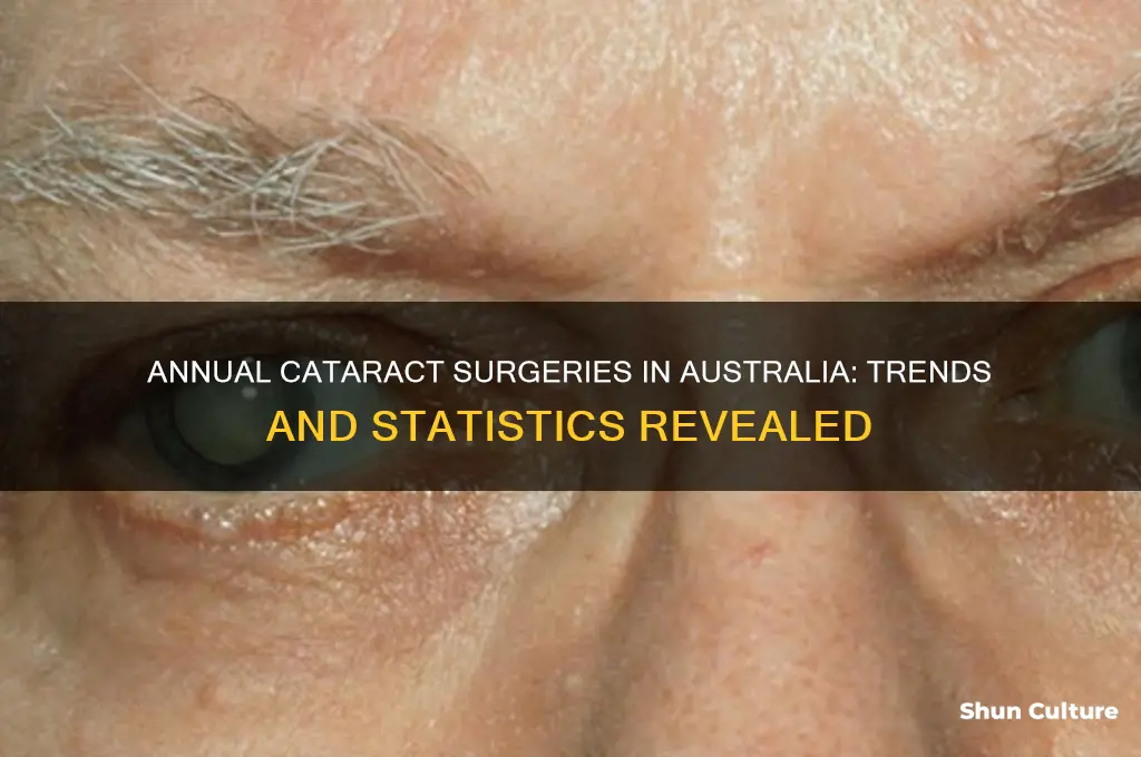 how many cataract surgeries per year in australia