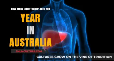 Annual Liver Transplant Rates in Australia: Current Statistics and Trends