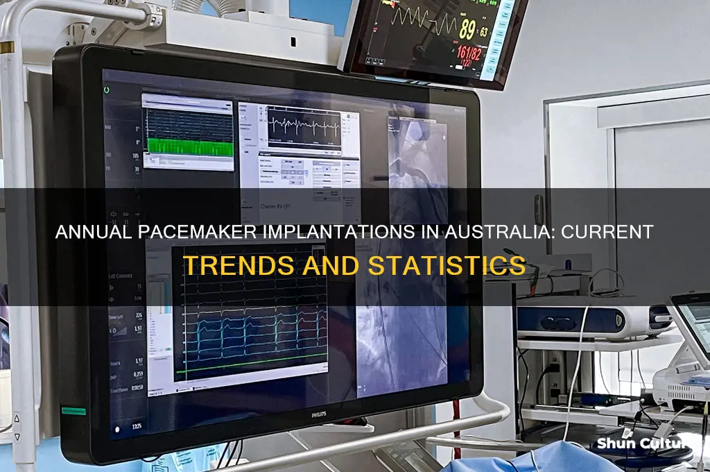 how many pacemakers are implanted each year in australia