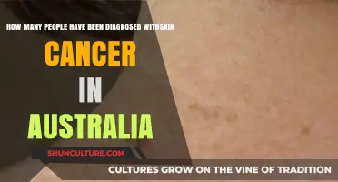 Skin Cancer in Australia: Diagnosed Cases