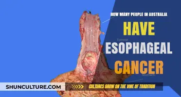 Esophageal Cancer Patients in Australia: Numbers Revealed
