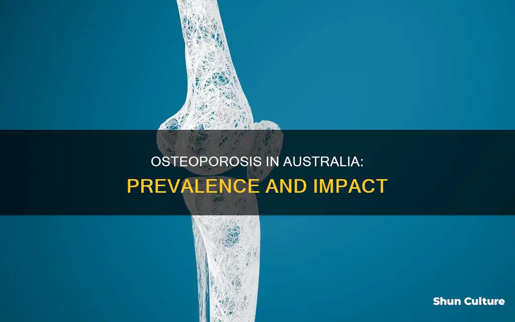 how many people in australia have osteoporosis