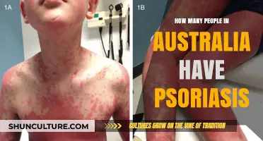 Psoriasis Prevalence in Australia: Understanding the Numbers