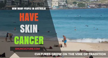 Skin Cancer in Australia: A Concerning Number