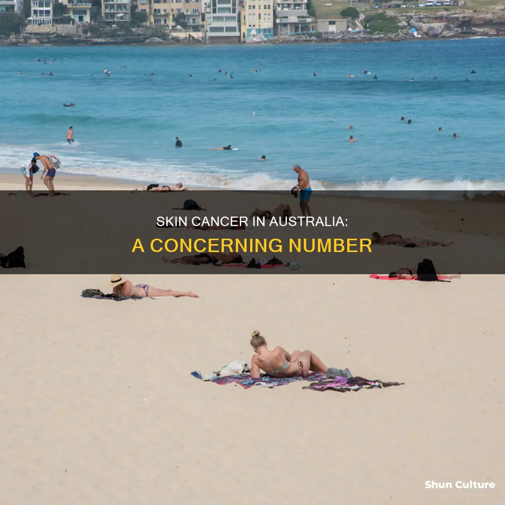 how many people in australia have skin cancer